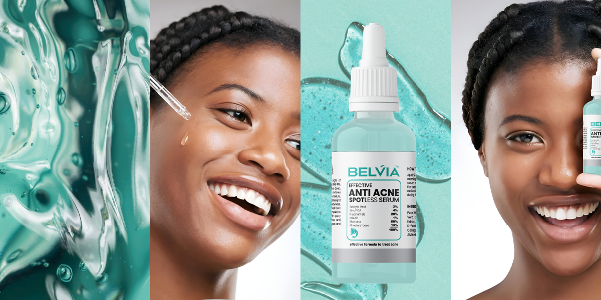 AntiAcne-EBC-3