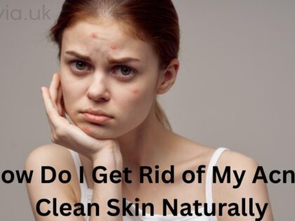 How Do I Get Rid of My Acne?